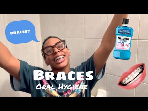 How to care for you braces and teeth